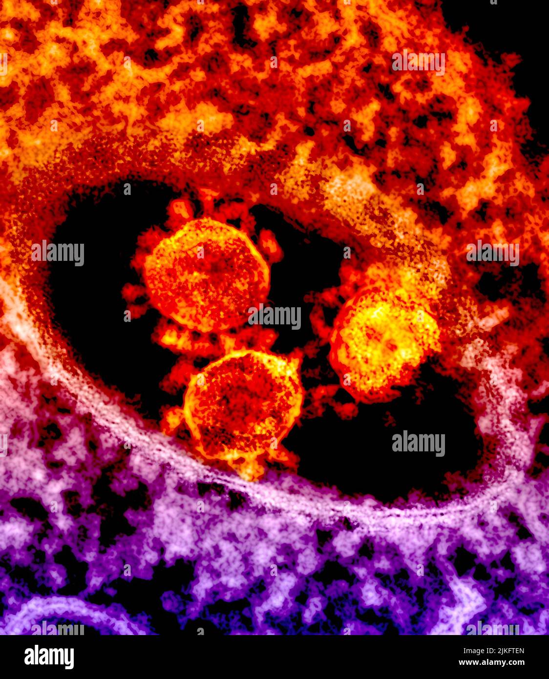 Die runden, spitzen Objekte in der Mitte des Bildes sind MERS-Coronavirus-Partikel. Stockfoto