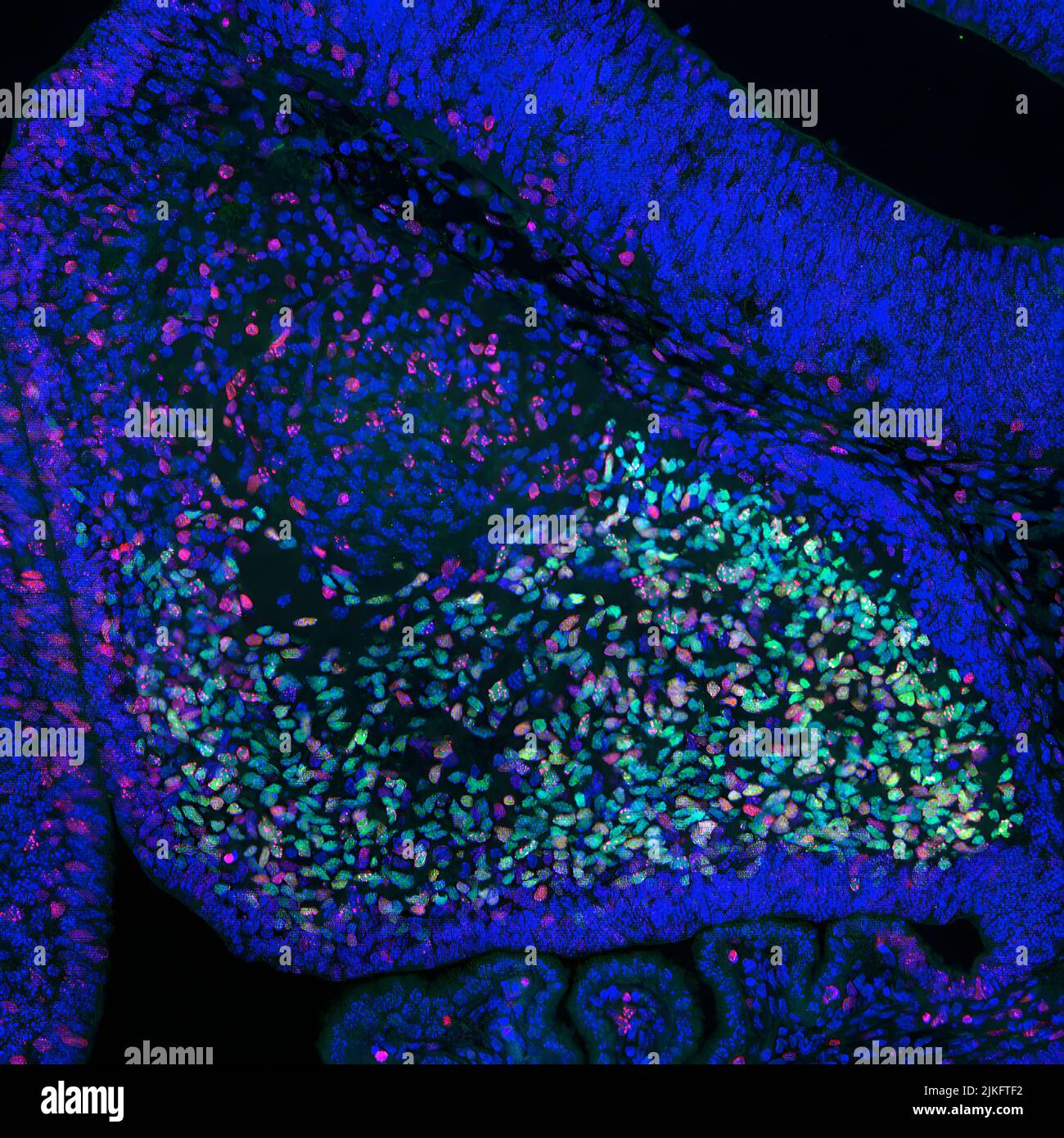 Dieses Foto zeigt das Zerebellum (Teil des Gehirns) eines Mausembryos. Multiplizierende Neuronen sind rot dargestellt. Purkinje-Zellen, eine bestimmte Art von Neuron, die für die Regulierung von Feinbewegung, Gleichgewicht und Haltung wichtig ist, werden grün dargestellt. Blaue Farbe zeigt alle Zellkerne an. Dieses Bild wurde im Rahmen einer von NIAMS unterstützten Studie zur Wirkung des Enzyms Ezh2 auf die Entwicklung von Neuronen im embryonalen Gehirn ausgezeichnet. Stockfoto