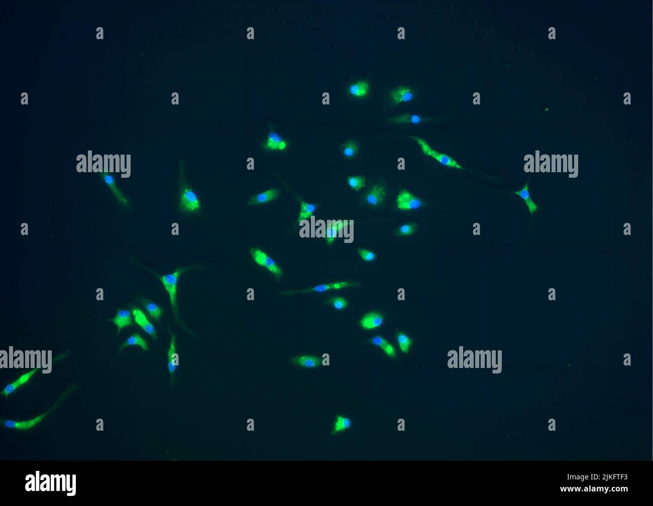 Mikroglia, grün dargestellt, sind Teil der Immunantwort, die das Gehirn schützt. Sie können eine Rolle bei der Verlangsamung des Fortschreitens von Prionen und anderen neurodegenerativen Erkrankungen spielen. Stockfoto