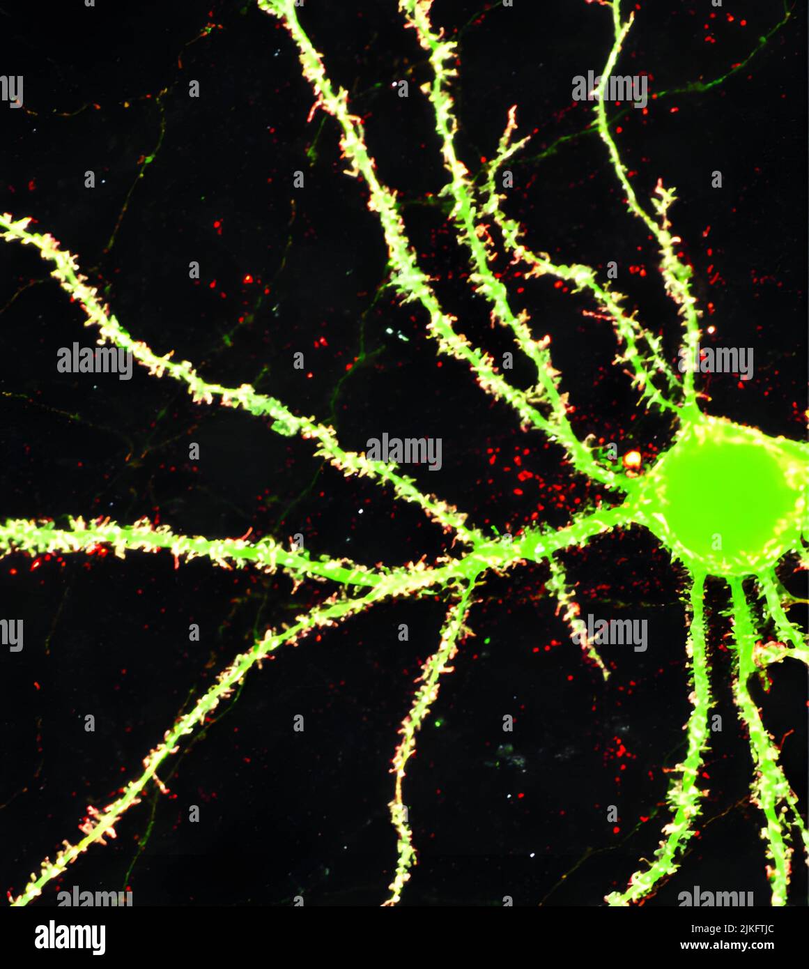 Eine neue Studie, die in Neuron veröffentlicht wurde, liefert Hinweise darauf, warum Autismus-Spektrum-Störungen bei Jungen häufiger auftreten als bei Mädchen. Wissenschaftler der nationalen Institute of Health haben herausgefunden, dass eine einzige Aminosäurenänderung im Gen NLGN4, die mit Autismus-Symptomen in Verbindung gebracht wurde, in einigen Fällen diesen Unterschied verursachen kann. Die Studie wurde am National Institute of Neurological Disorders and Stroke des NIH durchgeführt. Stockfoto