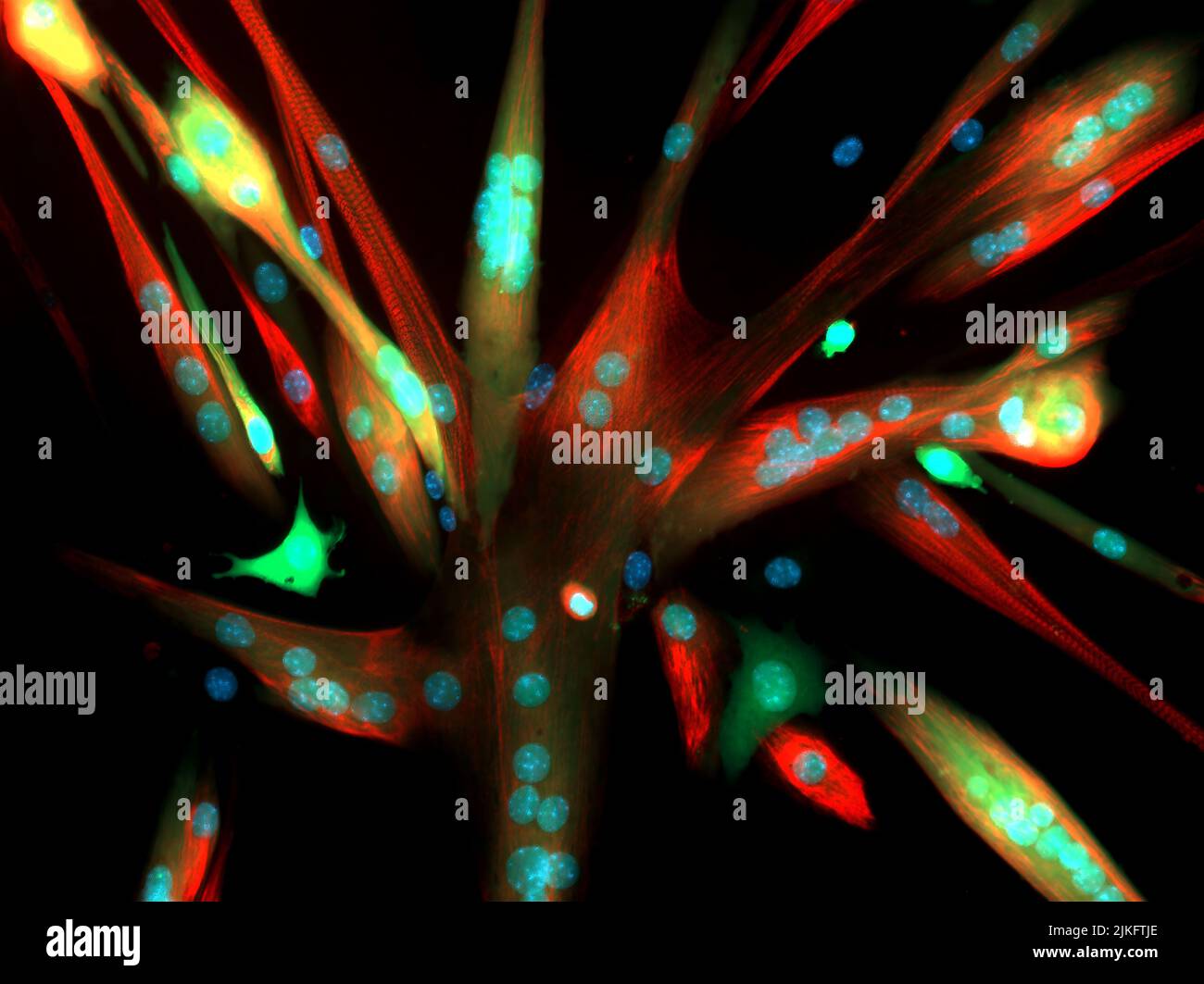 Dieses Bild zeigt Muskelzellen der Maus, die unter einem Mikroskop gesehen werden. Die Zellen haben sich zu Myotuben verschmolzen, die viele Kerne (blau gefärbt) haben. Die Zellen, die aus Stammzellen der Skelettmuskulatur der Maus mit einem harmlosen Virus hergestellt wurden, das sie grün leuchten ließ. Die grüne Farbe blieb erhalten, als sich die Stammzellen zu Myotuben verschmolzen haben. Einige Myotubes sind rot gefärbt für ein Protein, das an der Muskelkontraktion beteiligt ist (schwere Myosin-Kette), ein Merkmal von reifen Muskelfasern. Die Forscher sollten das gleiche virale Verabreichung-System verwenden, um Zellen genetisch zu modifizieren und zu beurteilen, wie eine Veränderung der Zellfusion das Myotubenwachstum beeinträchtigt. Stockfoto