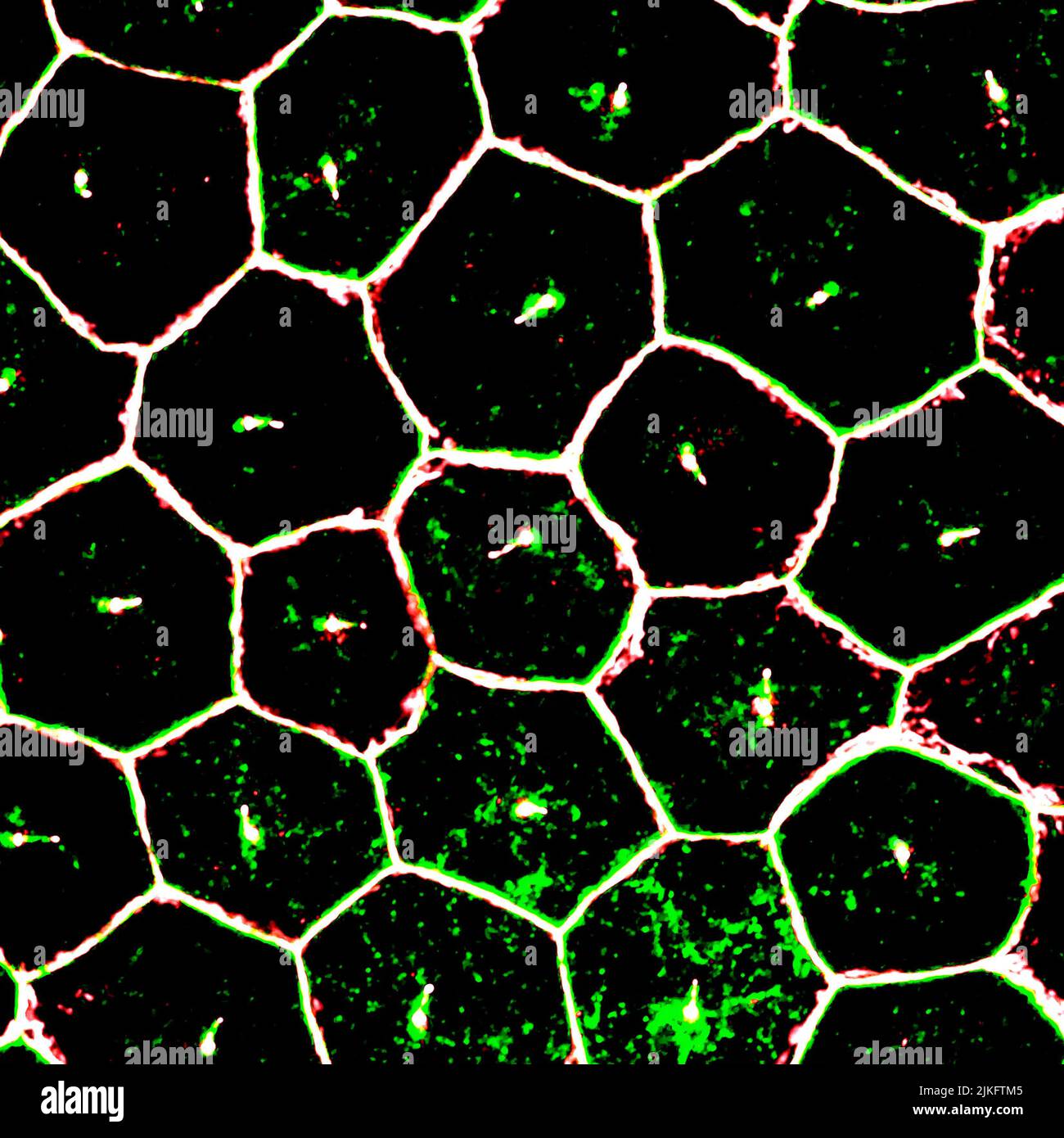Dieses Bild zeigt reife iPSCs (induzierte pluripotente Stammzellen), die aus retinalen Pigmentepithel-Zellen (RPE) gewonnen wurden und durch eine hochauflösende konfokale Mikroskopie vergrößert wurden. Stockfoto