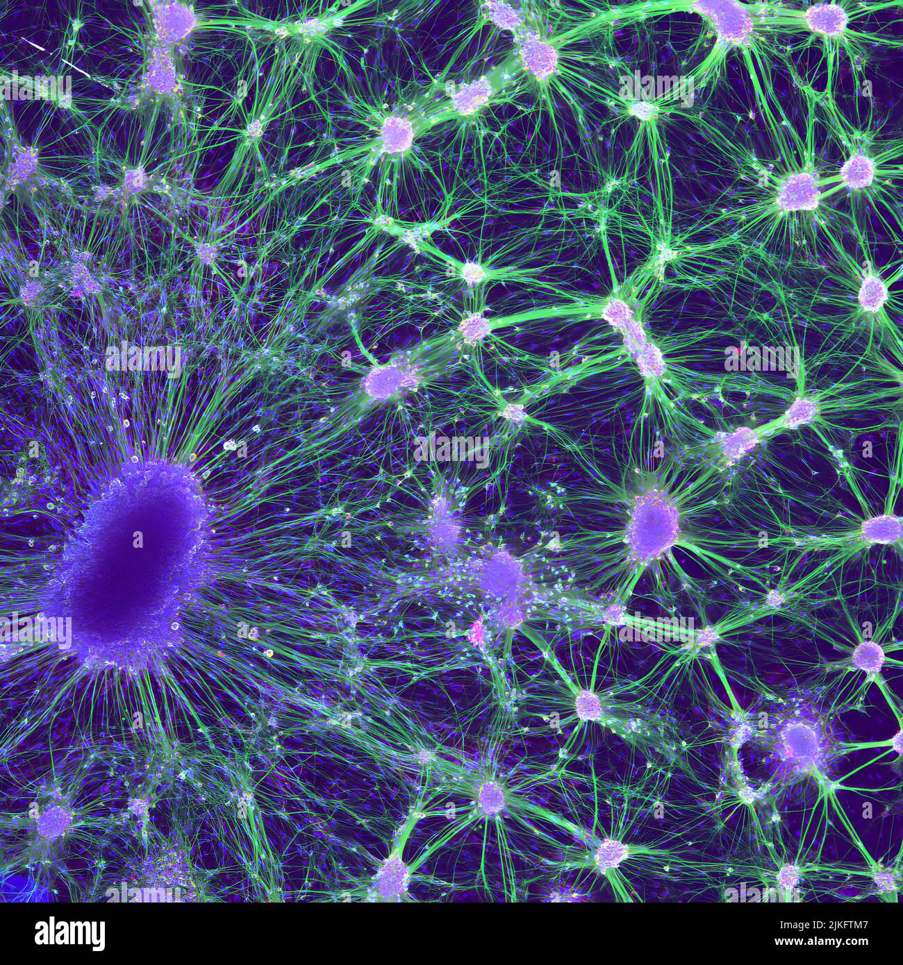 Dieses Bild zeigt Nervenzellen einer embryonalen Ratte, die in einer Petrischale wachsen. Unten links befindet sich ein dorsaler Wurzelganglion (dunkelviolett), eine Gruppe von sensorischen Nervenkörpern, die normalerweise außerhalb des Rückenmarks gefunden werden. Rechts befinden sich die Kerne (hellviolett) und Axone (grün) von Motoneuronen, die Nervenzellen sind, die an der Bildung wichtiger Signalnetzwerke beteiligt sind. Stockfoto