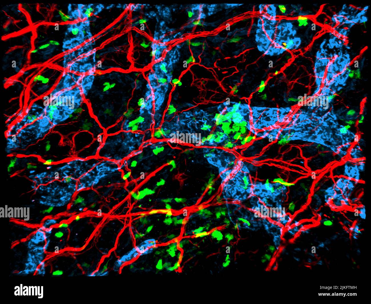 Wissenschaftler finden zunehmend Hinweise auf Interferenzen zwischen dem Nervensystem und dem Immunsystem bei vielen Krankheiten, einschließlich Psoriasis. Neuronen (rot) in der Maushaut kommunizieren mit dermalen dendritischen Zellen (grün), einer Art Immunzelle, um bei Psoriasis Entzündungen zu verursachen. Diese Rolle des Nervensystems eröffnet Forschern einen neuen Weg, Behandlungen für Psoriasis und möglicherweise andere entzündliche Hauterkrankungen zu entwickeln. Stockfoto