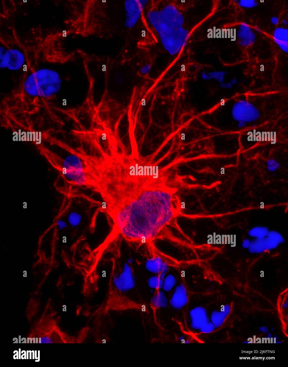 Forscher untersuchen sternförmige Gehirnzellen: Vom NIH finanzierte Forscher haben 3D Sammlungen von Hirngewebe aus menschlichen Zellen verwendet, um sternförmige Astrozyten im Gehirn zu untersuchen. Stockfoto