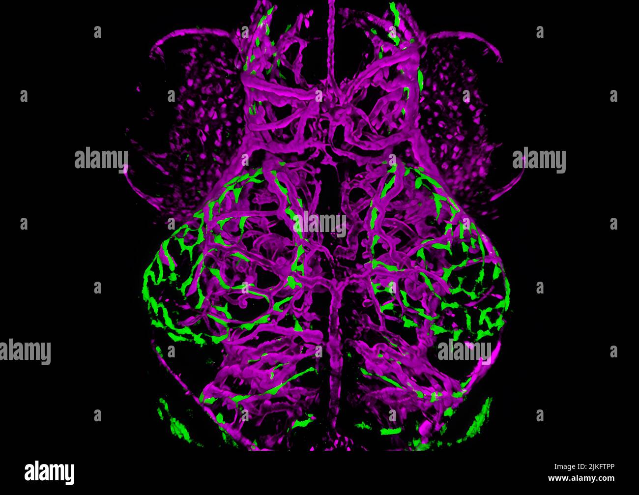 Dorsale Ansicht des Gehirns eines 10 Tage alten doppelt transgenen Zebrafischs (MRC1a:eGFP Kdrl:mcherry). Blutgefäße werden in Magenta und eine neue Population perivasulärer Endothelzellen in Grün dargestellt. Stockfoto