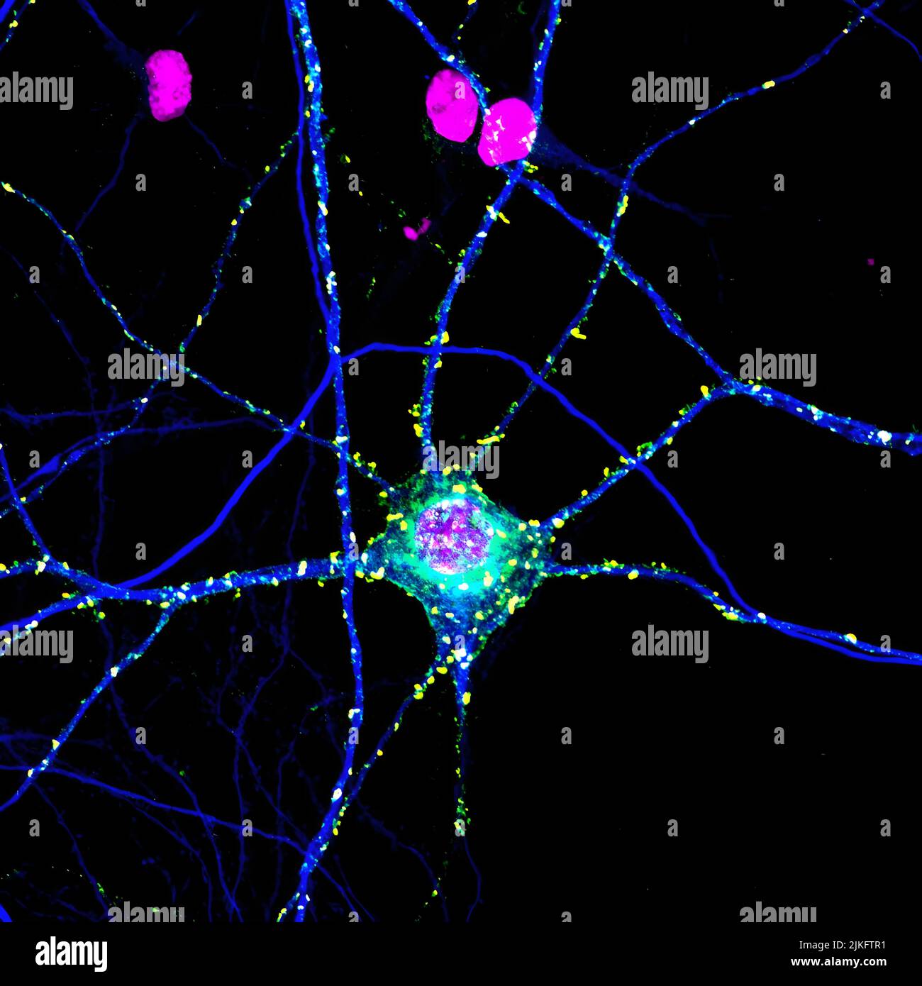Signale, die Neuregulin (rot) und ErbB4 (grün) genannt werden, werden in Neuronen angefordert. Der Zellkern (magenta) und MAP2 (blau) werden ebenfalls angezeigt. Stockfoto