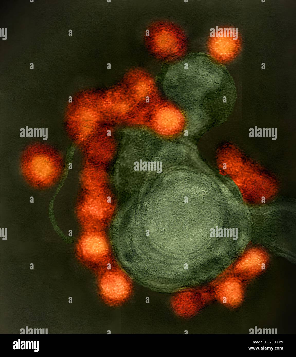 Transmissions-Elektronenmikroskop-Aufnahme des Fortaleza-Stamm-Zika-Virus (rot), negativ gefärbt, isoliert von einem Fall von Mikrozephaly in Brasilien. Stockfoto