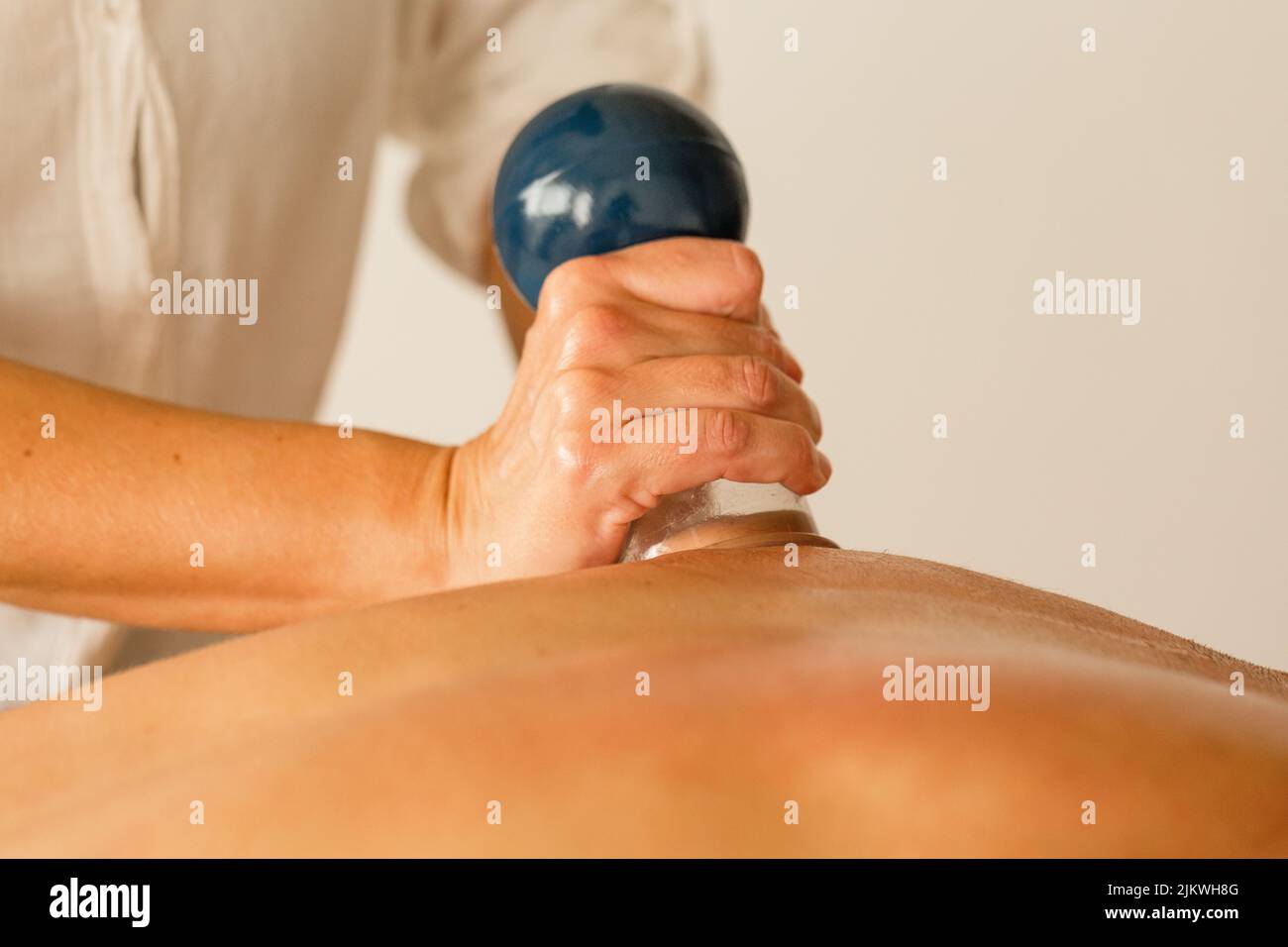 Therapeutische Massage mit Saugnäpfen bei einem hellhäutigen Mann Stockfoto