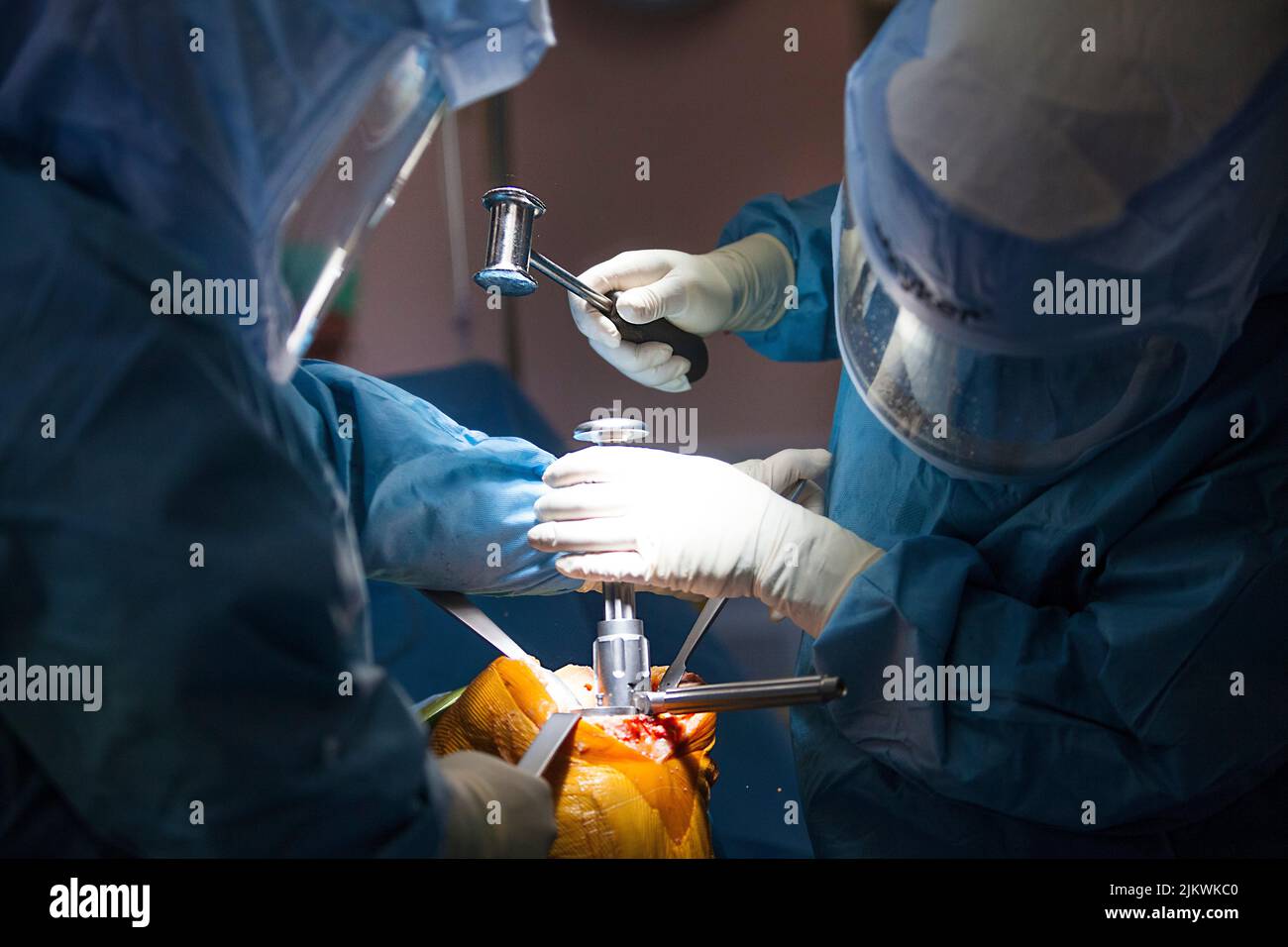 Orthopädische Chirurgie Operationssaal für totalen Knieersatz, Chirurgen und Instrumente. Stockfoto