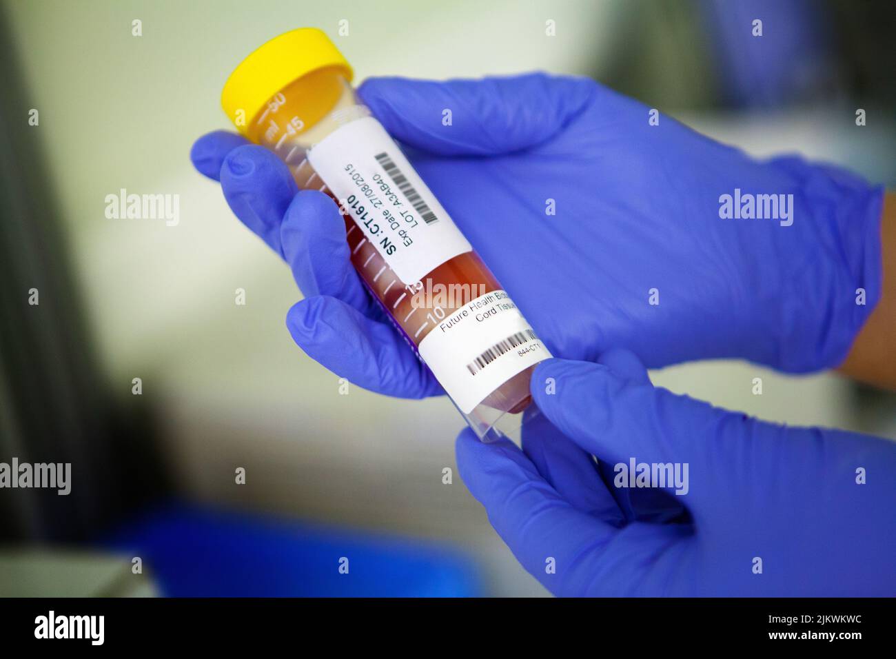 Biobank zur Speicherung von Stammzellen aus Blut und Kordelgewebe. Stockfoto