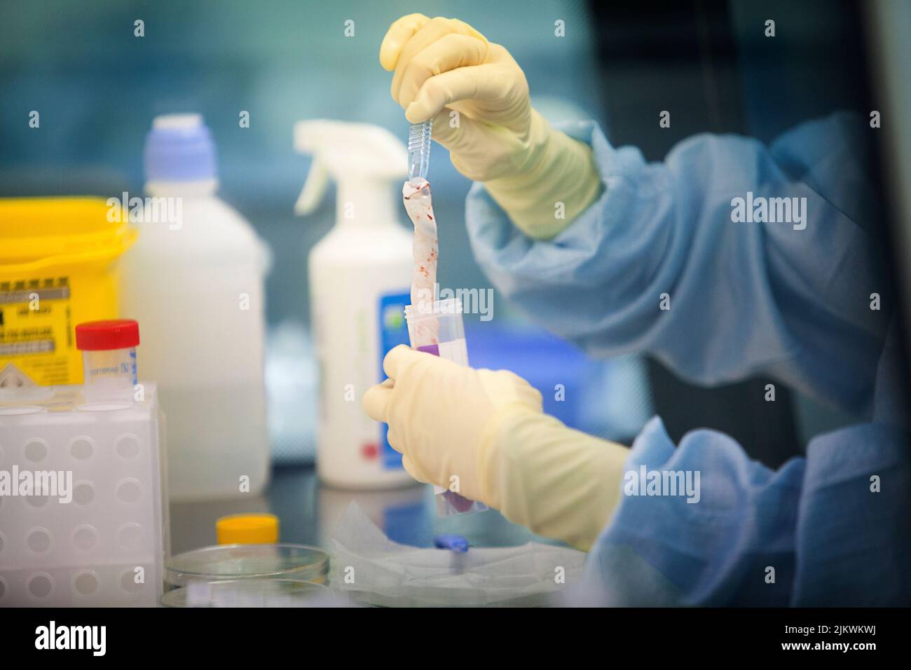 Biobank: Nabelschnurgewebe vor der Stammzellisolation gewaschen und gelagert. Stockfoto