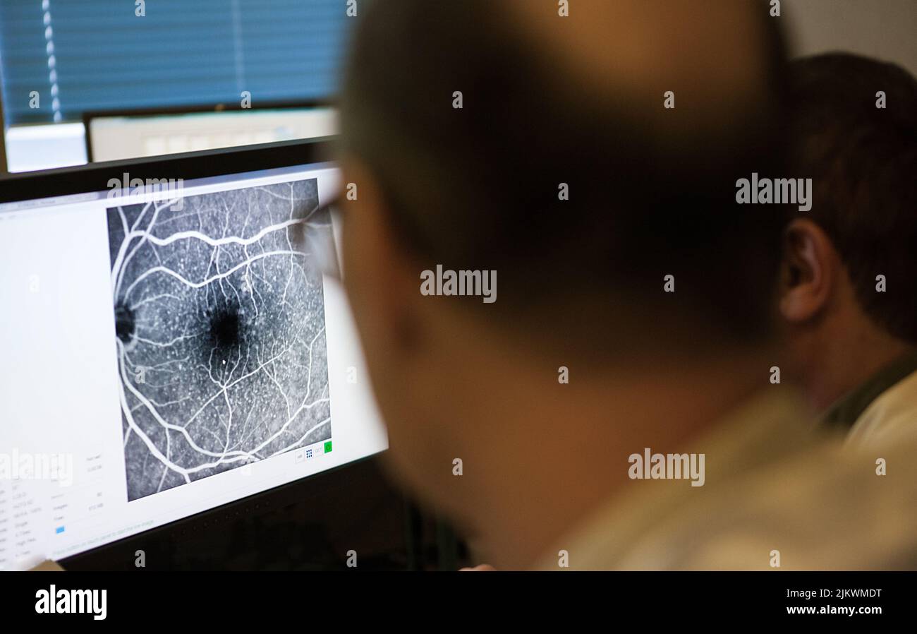 Durchführung eines Kontrollangiogramms des Auges in einer ophthalmologischen Praxis. Stockfoto