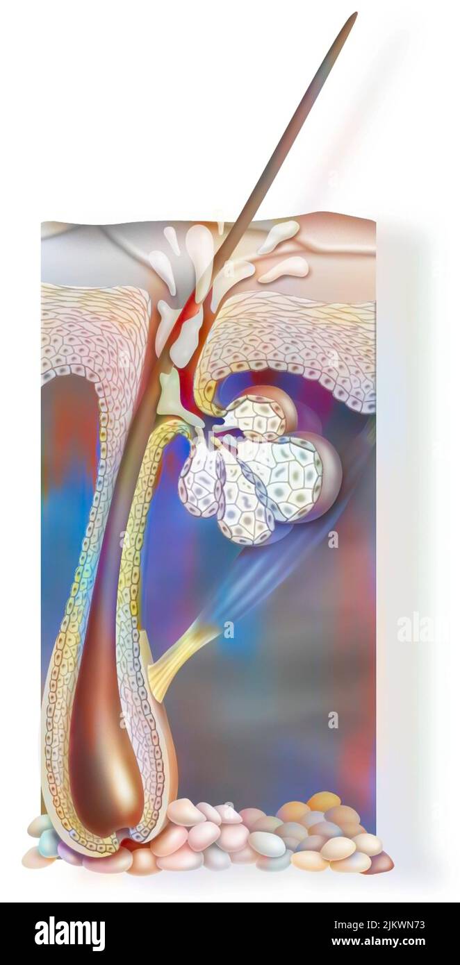 Haut: Anatomie eines Integuments, das tief in der Dermis liegt. Stockfoto Haut: Anatomie eines Integuments, das tief in der Dermis liegt. Stockfoto
