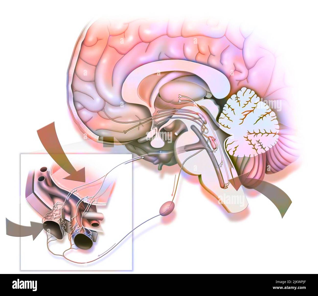 Migräne wird angeblich durch Stimulation des Trigeminusnervs verursacht. Stockfoto