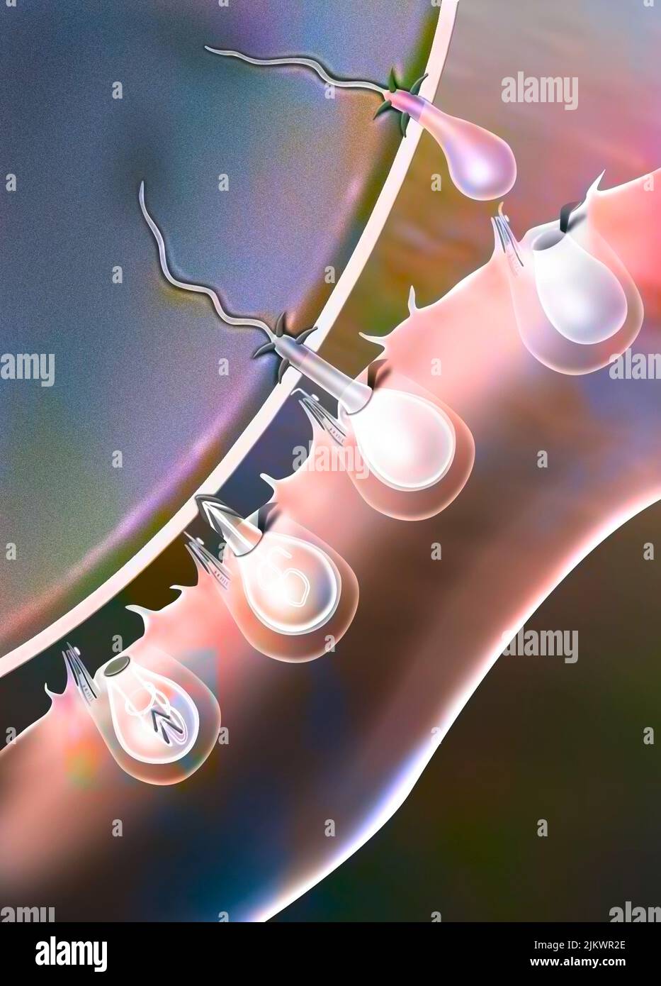 Stechender Quallen-Stich: Der Stachel dringt in das Opfer ein und spritzt sein Toxin ein, das für Verbrennungen verantwortlich ist. Stockfoto