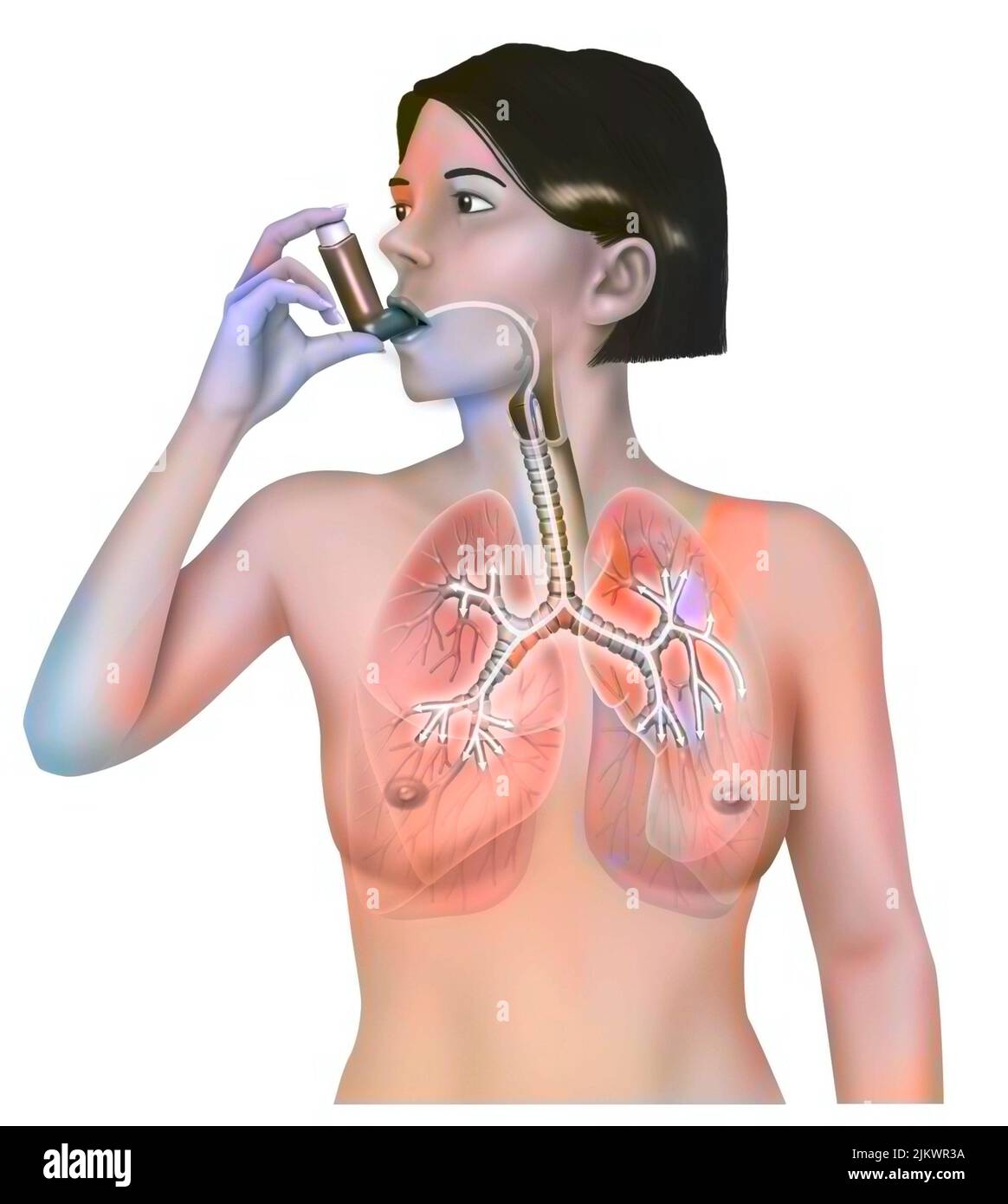 Frau, die einen Inhalator nimmt, um einen Asthmaanfall zu lindern. Stockfoto