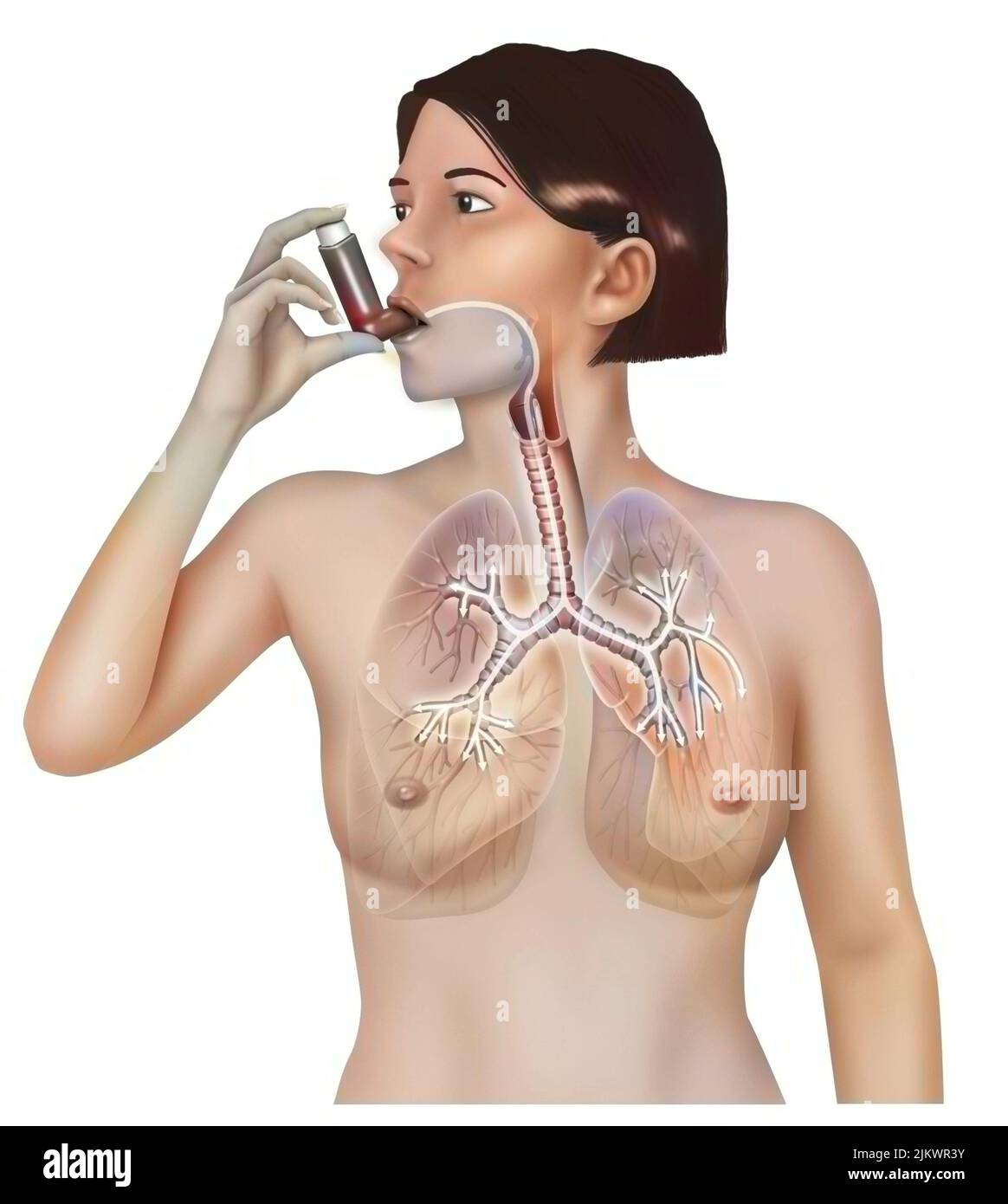 Frau, die einen Inhalator nimmt, um einen Asthmaanfall zu lindern. Stockfoto
