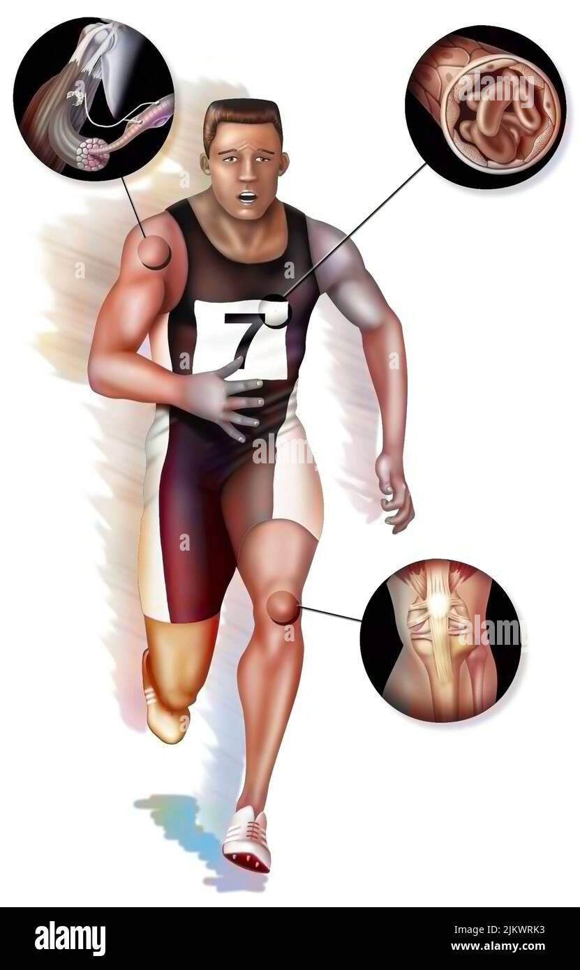 Sportler in der Anstrengung mit Zoom auf die Organe stimuliert im Falle von Doping. Stockfoto
