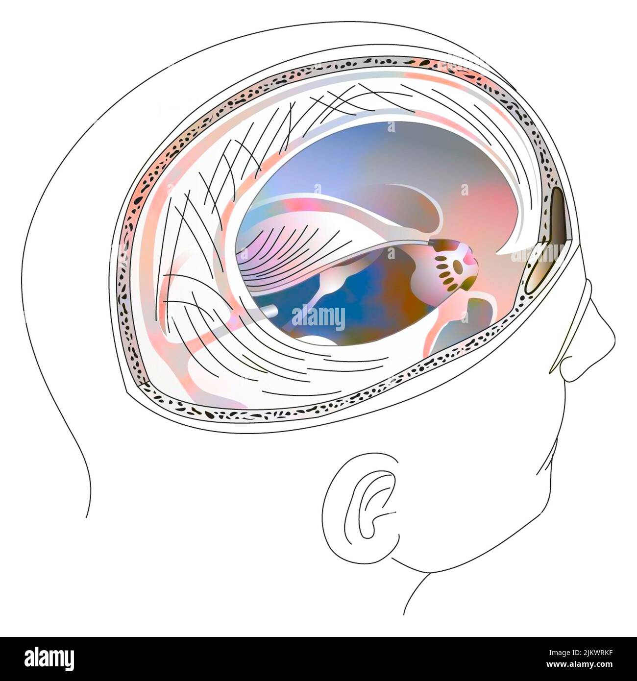 Meningeale Membranen, die sowohl das Gehirn als auch das Zerebellum umhüllen. Stockfoto