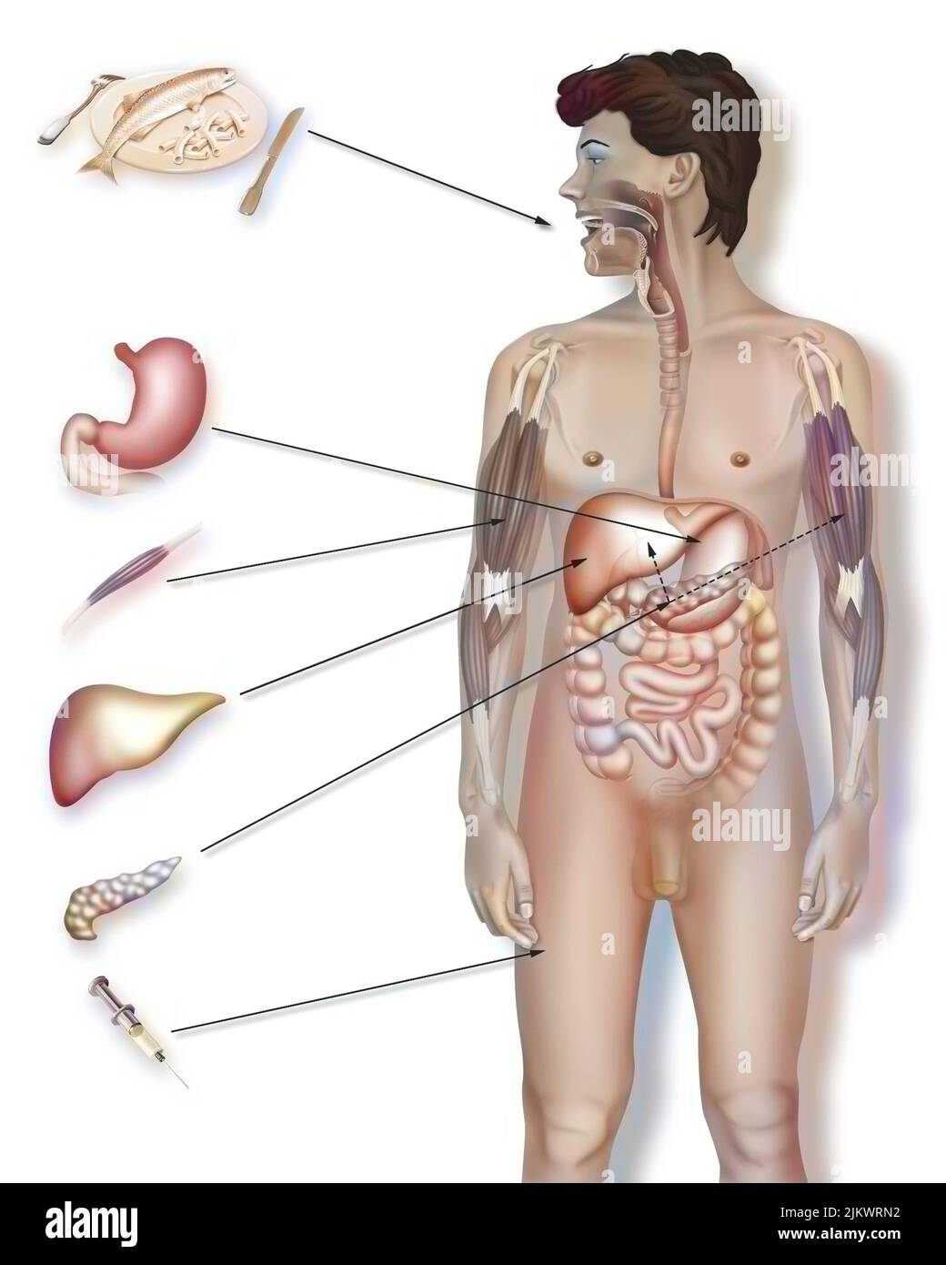 Medikamentöse Behandlung von Diabetes: Eine geeignete Ernährung, Alphaglucosidase-Hemmer, Biguanide. Stockfoto