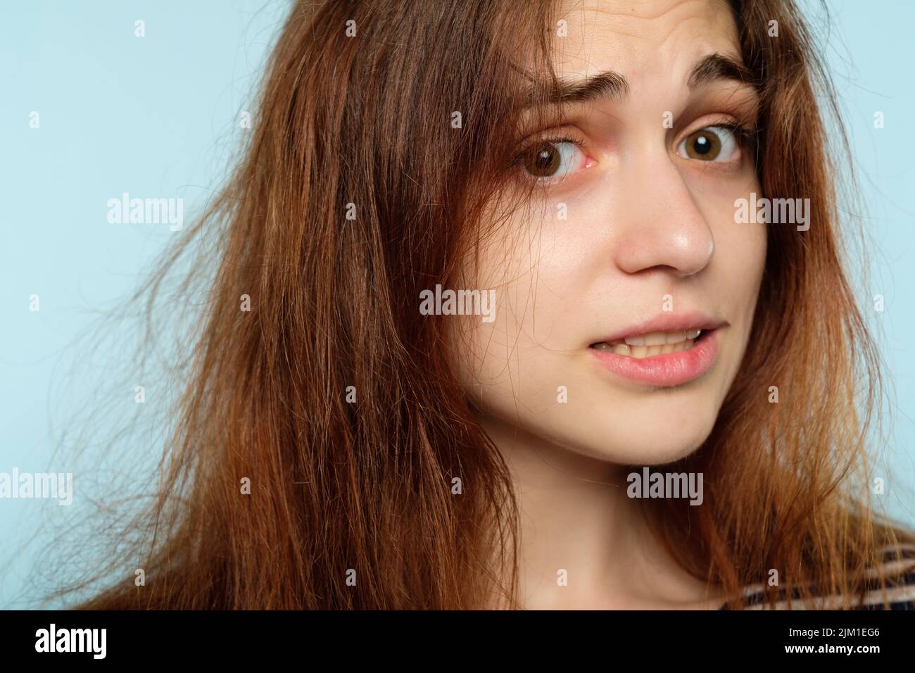 Winter Frisur statische Haarpflege gestresste Frau Stockfoto