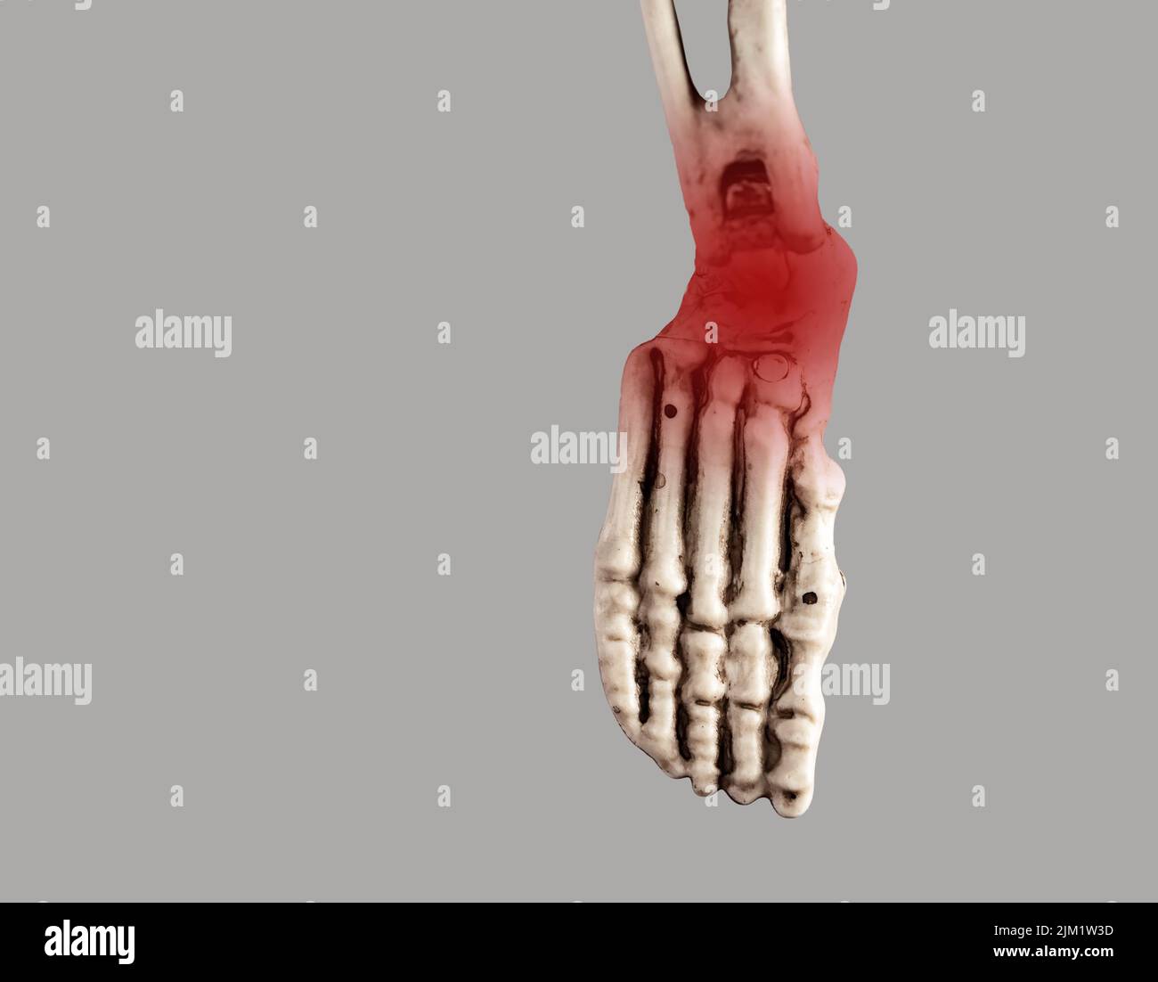 Menschlicher Skelettfuß mit roter Spitze an Ferse und Knöchel. Verletzungen, plantare Fasziitis, Sehnenentzündung Folgen. Medizinische Bedingungen, Anatomiekonzept. Hochwertige Fotos Stockfoto
