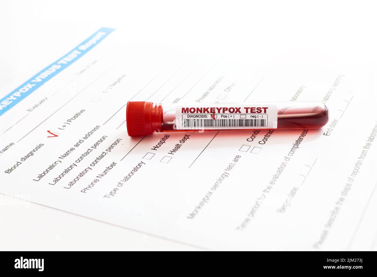 Röhrchen mit positivem Monkeypox-Testblut bei Analyse bilden Nahaufnahme mit Kopierraum Stockfoto