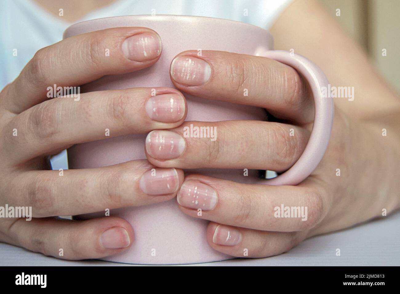 Viele flecken -Fotos und -Bildmaterial in hoher Auflösung – Alamy