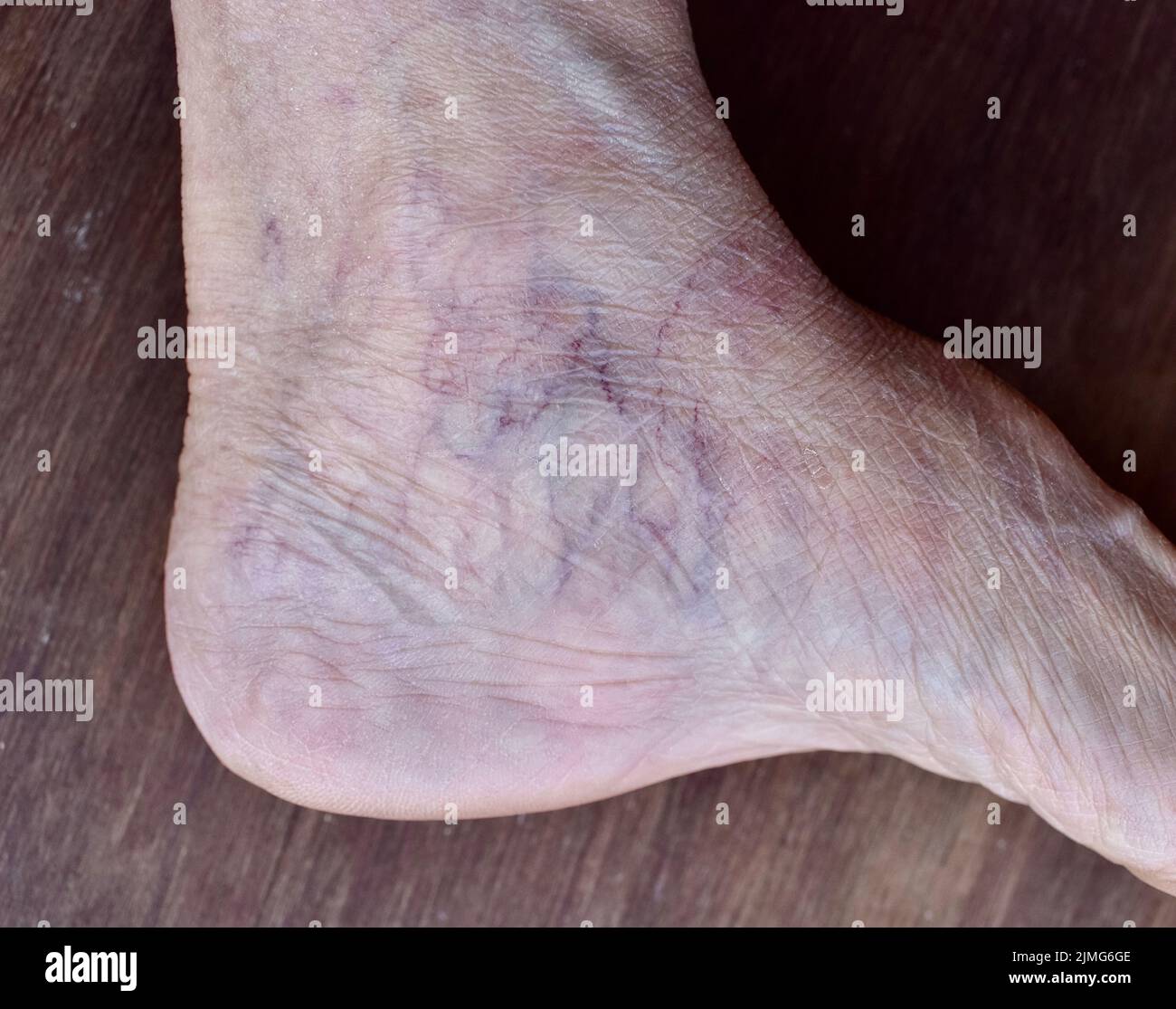Hautfalten und markante Venen, die durch die dünne Fußhaut der alten asiatischen Frau sichtbar sind. Stockfoto