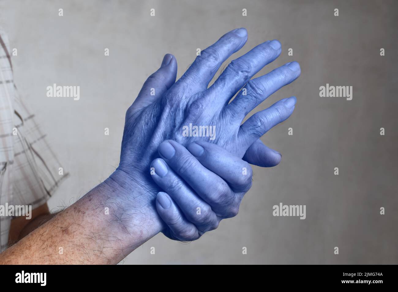 Hellblaue Hände des alten asiatischen Mannes. Konzept der kalten und unbeholfenen Hand. Stockfoto