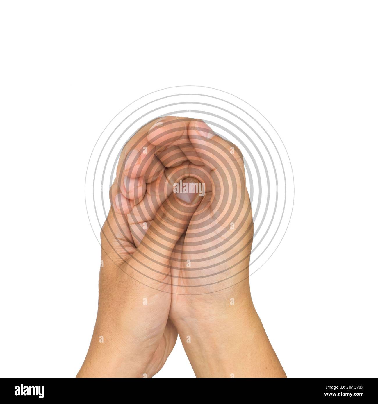 Schmerzhafter Palmar-Aspekt des asiatischen jungen Mannes. Konzept des Kompartiment-Syndroms und Schmerzen der Handmuskulatur. Stockfoto