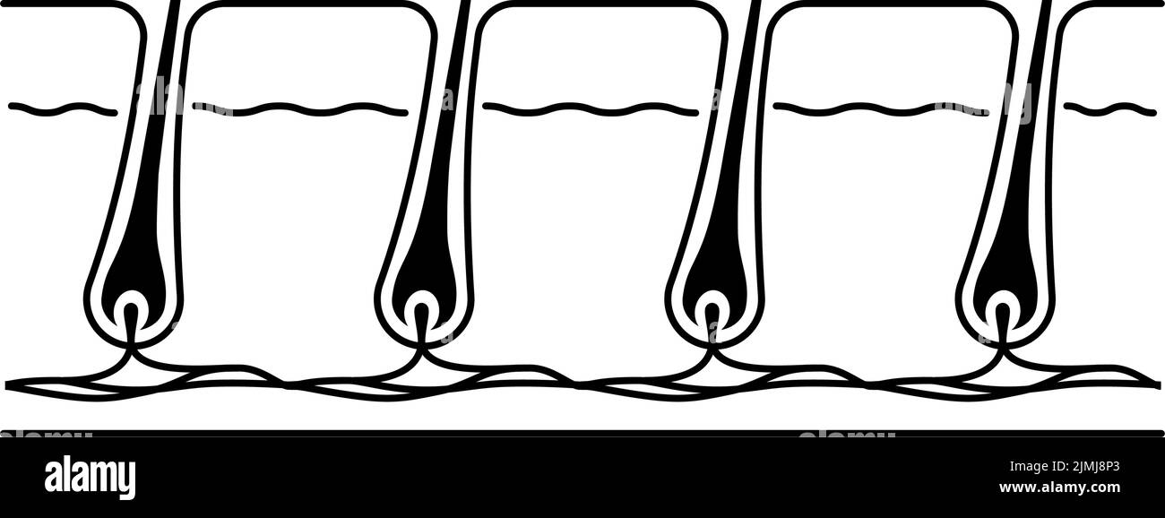 Bild der Haarentfernung, nach der Haarentfernung, selbst behandelt Stock Vektor