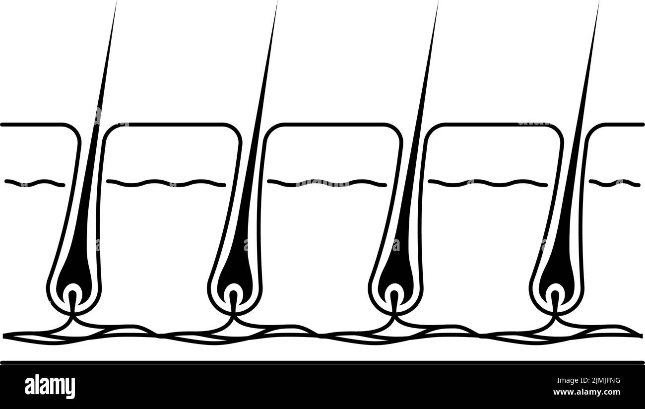 Bild der Haarentfernung, vor und unbehandeltes Haar Stock Vektor