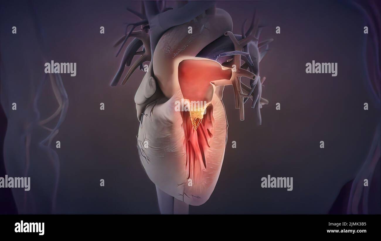 Das menschliche Herz pumpt Blut. Herz - Anatomie des menschlichen