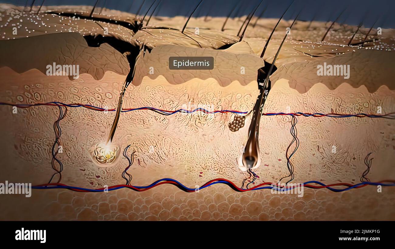 Inflammation of the skin Fotos und Bildmaterial in hoher Auflösung Alamy