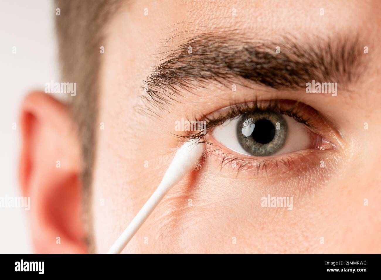 Mann, der sein Auge mit einem Wattestäbchen reinigte Stockfoto