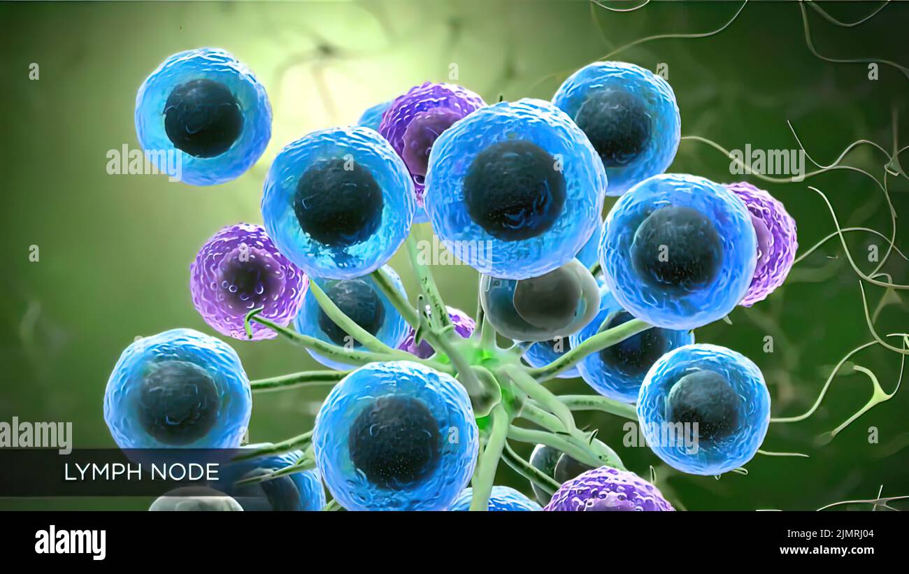 Wo Befinden Sich Die Lymphknoten