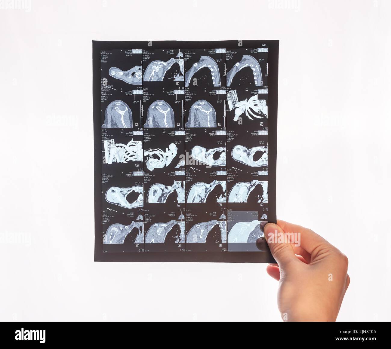 CT. Hand halten computerisierte Tomographie Scan-Bild. Krankheiten Diagnose, Überprüfung auf Verletzungen, Trauma, Tumoren Erkennung. Gesundheit, Medizin concep Stockfoto