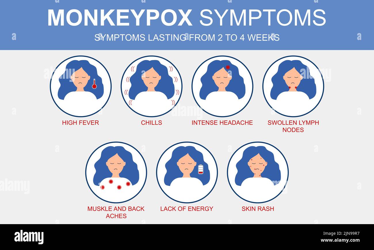 Ausbruch der Monkeypox. Infografik zu Symptomen des Monkeypox-Virus. Stock Vektor