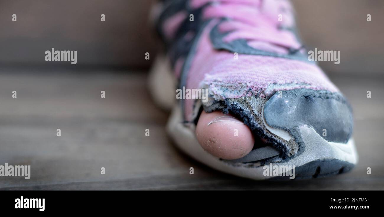 Alte Schuhe mit Löchern abgenutzt schäbig für Obdachlose Kleidung Zehen ragen Stockfoto