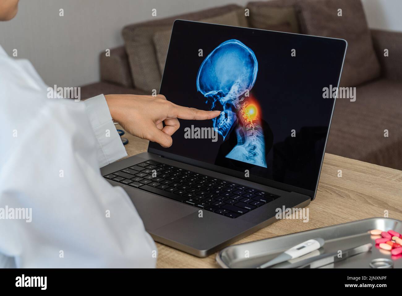 Arzt, der eine Röntgenaufnahme von Schmerzen im Nacken zeigt. Migräne und Rückenschmerzen. Stockfoto