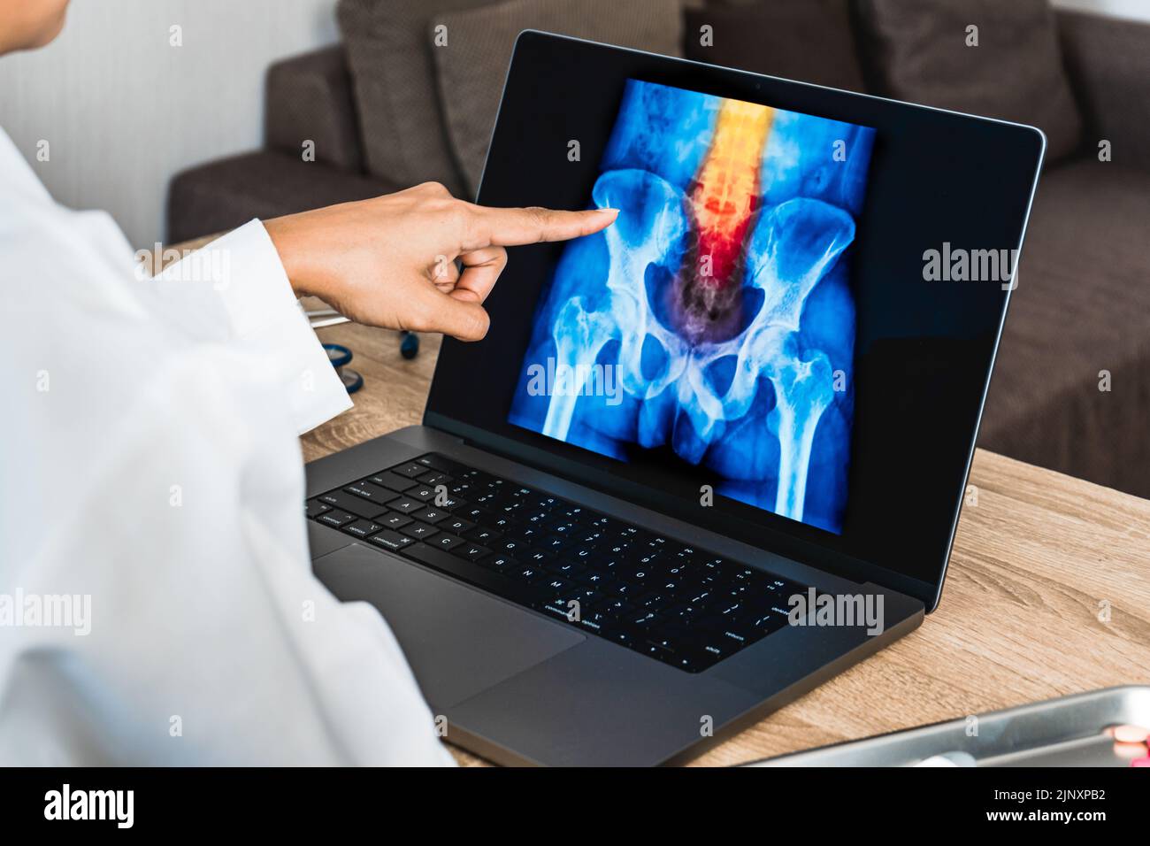 Arzt schaut auf eine Röntgenaufnahme von Schmerzen in der Wirbelsäule. Trauma bei Rückenschmerzen Stockfoto