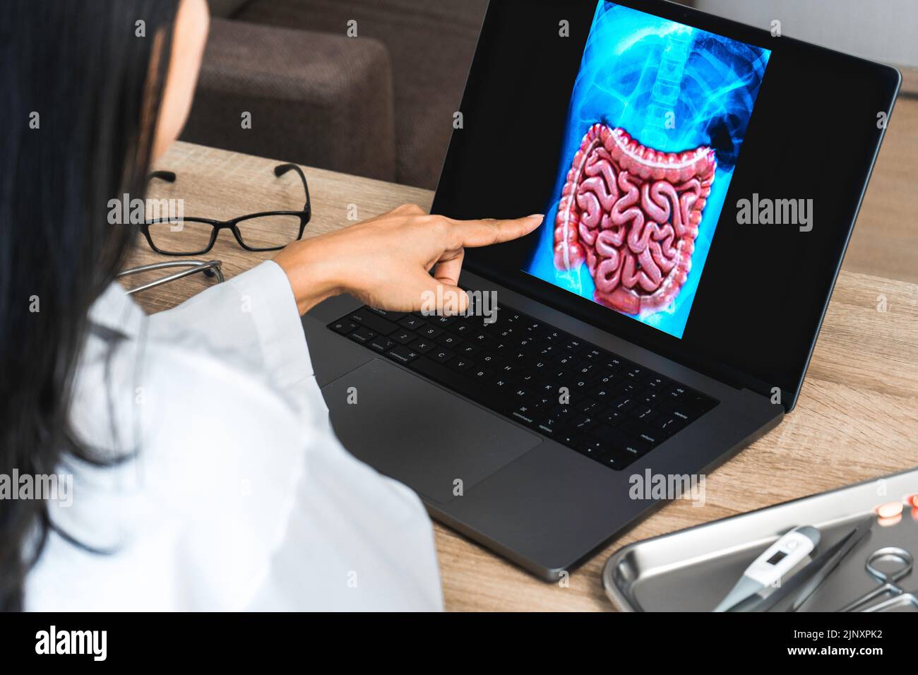 Arzt, der eine Röntgenaufnahme von Magen und Darm zeigt Stockfoto