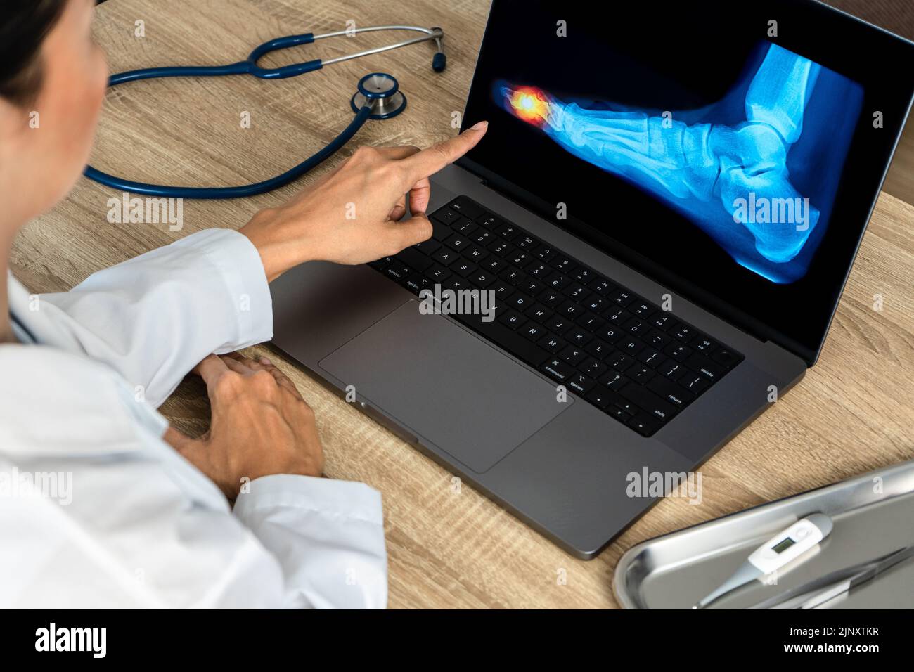 Nahaufnahme eines Arztes, der eine Fußröntgenaufnahme zeigt. Schmerzen Zehen Verletzung Stockfoto