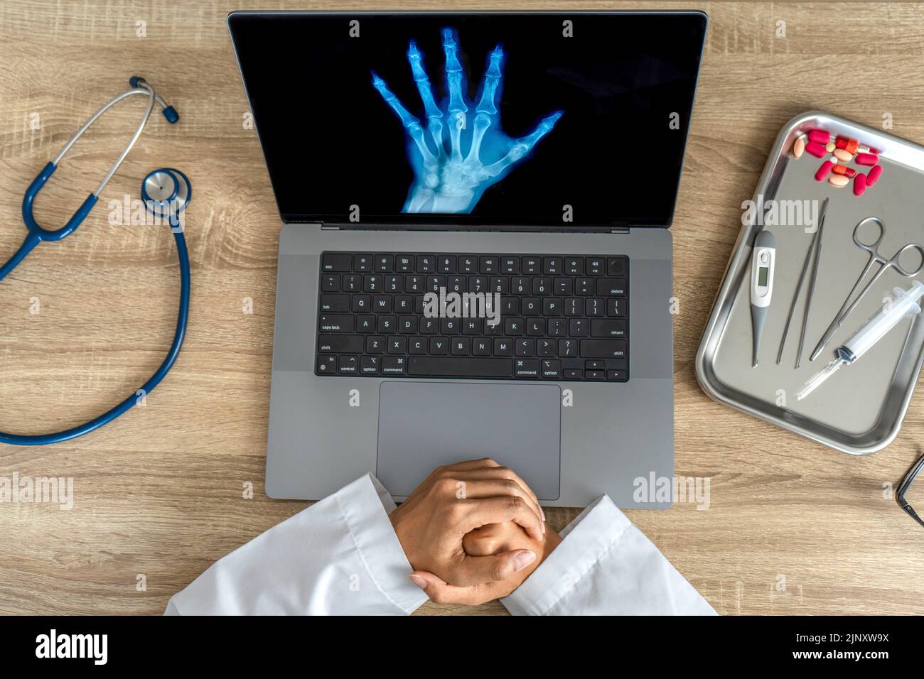 Draufsicht auf den Arzt aussehende Röntgenaufnahme der Hand Stockfoto