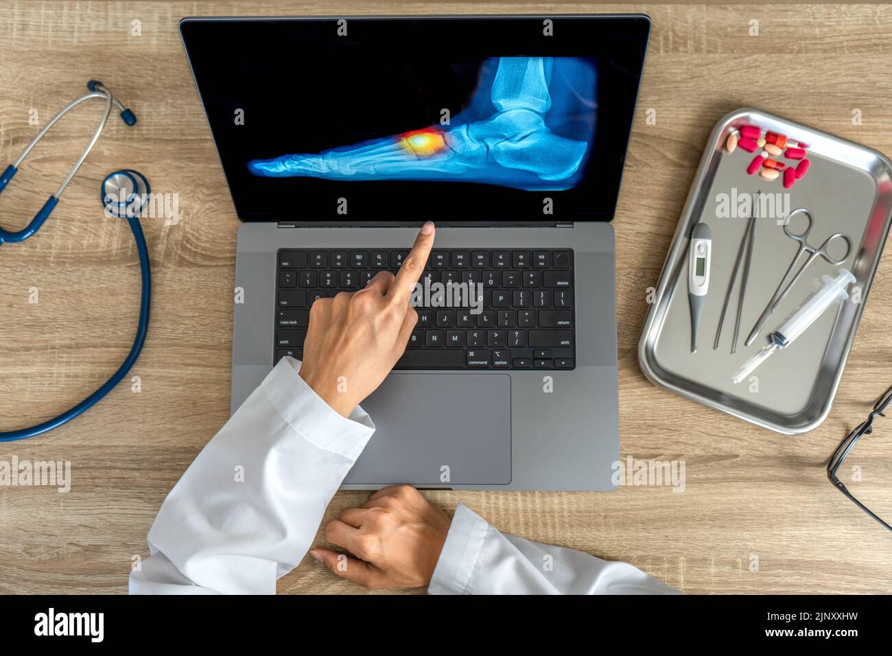 Draufsicht des Arztes mit einer Röntgenaufnahme des Fußes. Schmerzverletzung Stockfoto