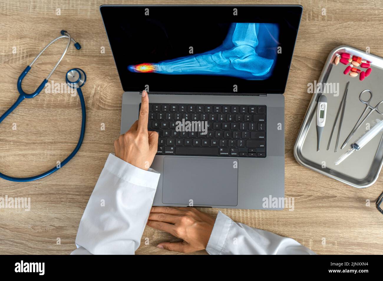 Draufsicht des Arztes mit einer Röntgenaufnahme des Fußes. Schmerzen Zehen Verletzung Stockfoto