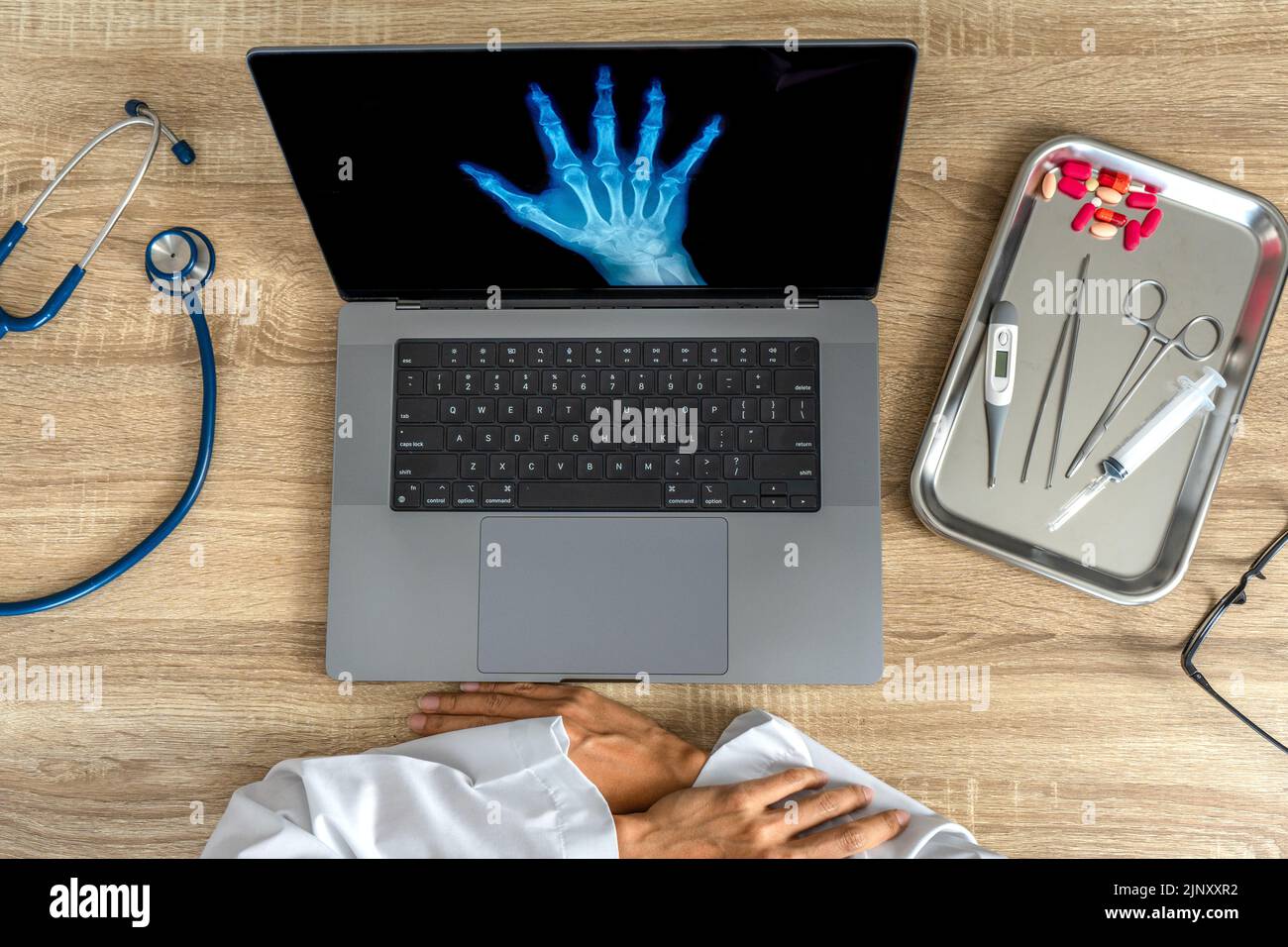 Draufsicht auf den Arzt aussehende Röntgenaufnahme der Hand Stockfoto