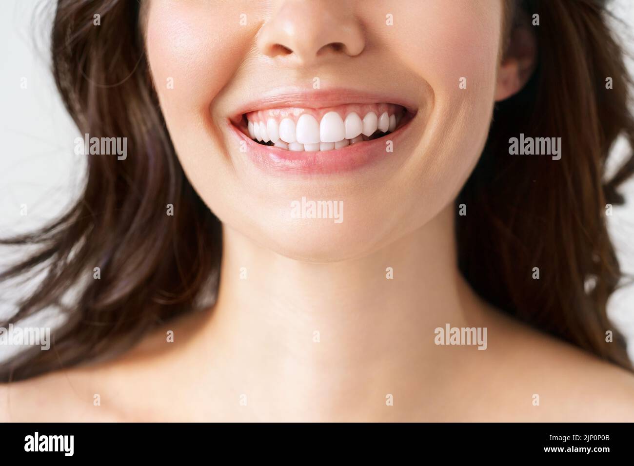 Das Lächeln einer Frau in Nahaufnahme, nach dem Zahnaufhellungsverfahren beim Zahnarzt, Stockfoto